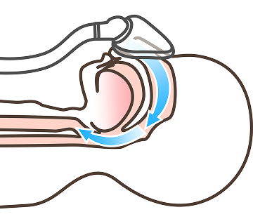CPAP