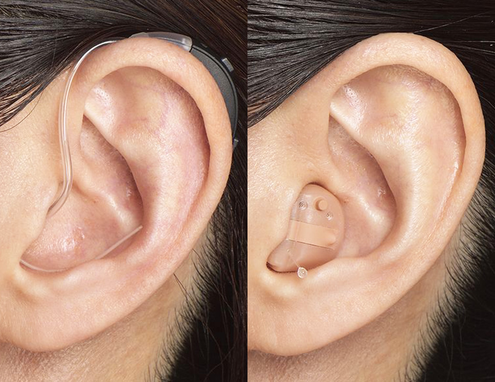 聴こえの改善を目指す医療としての補聴器外来 佐賀県武雄市 くさの耳鼻咽喉科・小児科